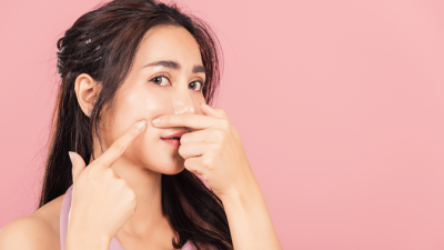 6 Cara Jitu Menghilangkan Jerawat Membandel